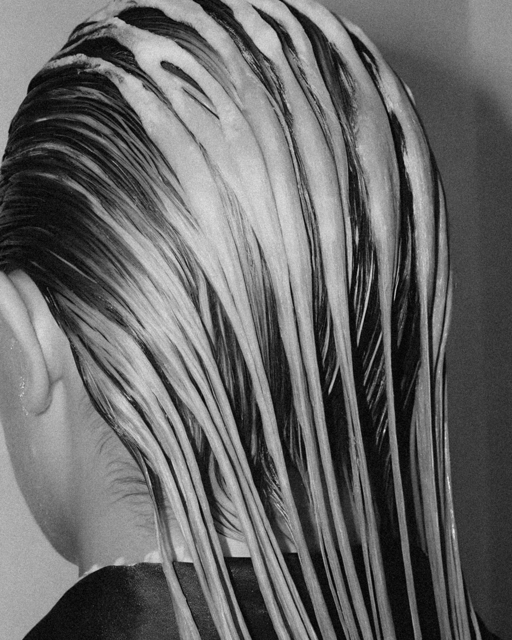 PRP hair restoration treatment in Weymouth MA