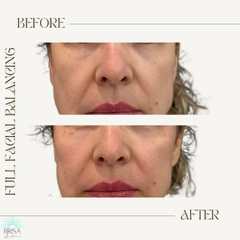 full facial balancing 1