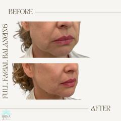 full facial balancing 10