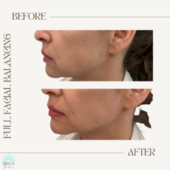 full facial balancing 11