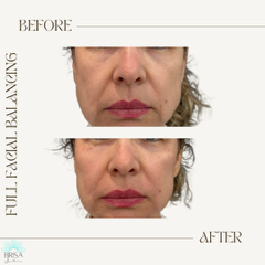 full facial balancing 12