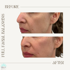 full facial balancing 4