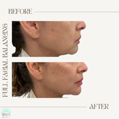 full facial balancing 9