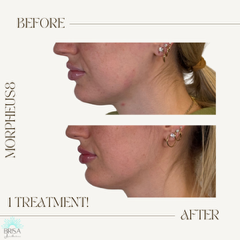 m8 after 1 treatment