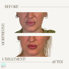 m8 after 1 treatment 1